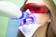 laser teeth whitening